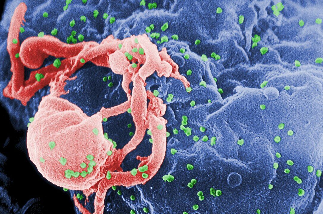 ADN Viking sugeruje, że mutacja genetyczna, która walczy z HIV, pojawiła się 9 000 lat temu z Morzem Czarnym